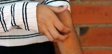 A person scratching their arm