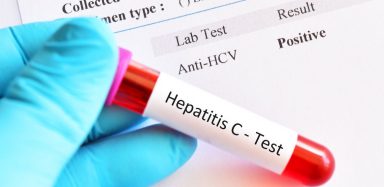 A vial being held in a gloved hand, labelled "hepatitis c"