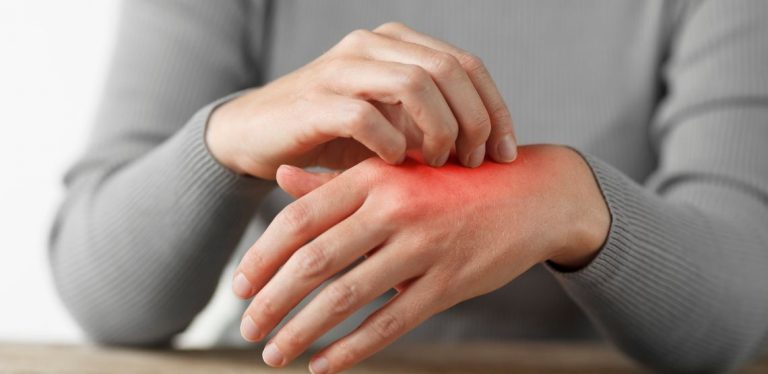 common skin conditions